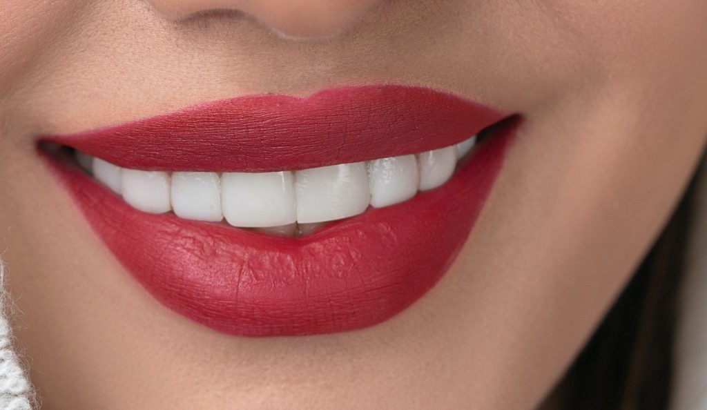 blanqueamiento dental